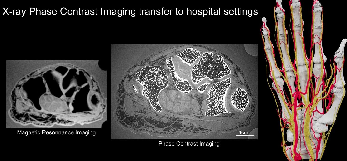 X-ray Phase Contrast Imaging